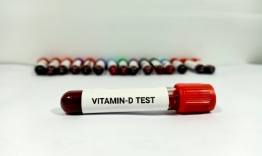 Top Companies in Vitamin D Testing Market by Size, Share, Historical and Future Data & CAGR | Report by Vantage Market Research