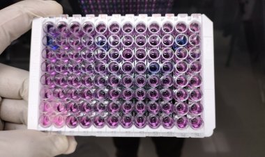 Immunoassay Market Size to Reach $40,183.23 Million at a CAGR of 6.40% by 2028