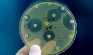 Lipid Nanoscheiben Markt Größe zu erreichen 1,7 Milliarden Dollar bei einer CAGR von 7,7 % bis 2028