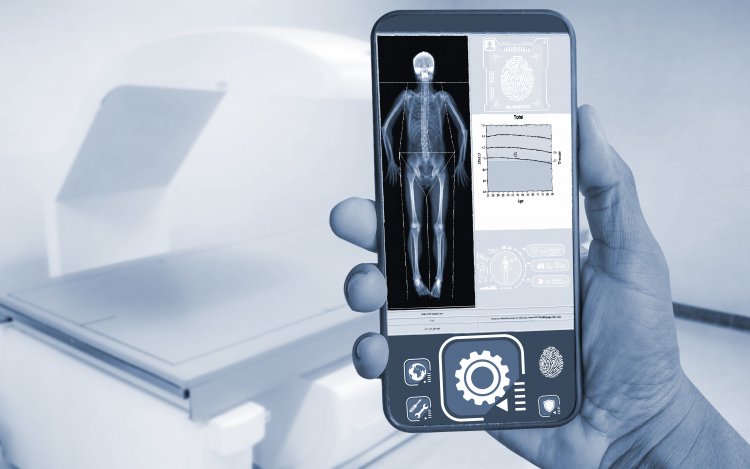 Global Smartphone Enabled Medical Devices Market Size to Reach $98.2 Billion at a CAGR of 16.3% by 2030