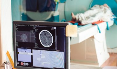 Global Spatial OMICS Market Size to Reach $424.2 Million at a CAGR of 10.5% by 2030