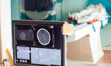 Das weltweite Marktvolumen für räumliche OMICS wird bis 2030 424,2 Millionen US-Dollar erreichen und eine durchschnittliche jährliche Wachstumsrate von 10,5 % aufweisen