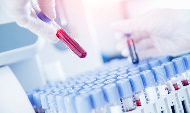 To Register Unwavering Growth Of Multicancer Detection Market 2024: Analysis by Current Insights, Future Dynamics and Innovative Strategies by 2032