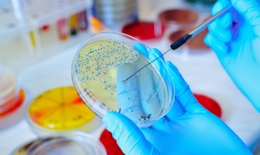 Rapid Microbiology Testing Market Size, Analytical Overview, Growth Factors, Demand and Trends Forecast to 2032