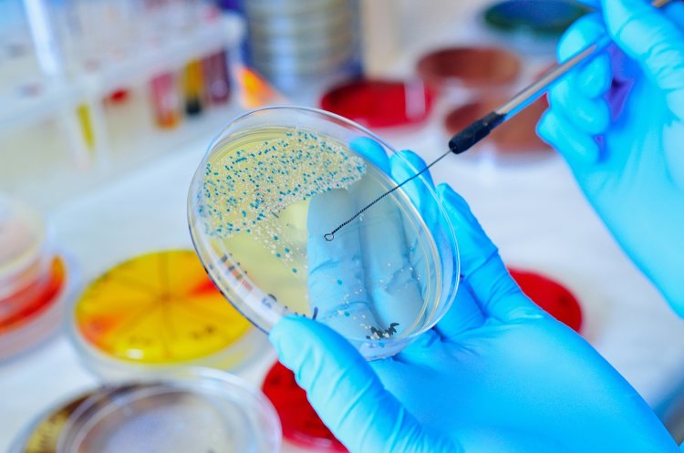 Rapid Microbiology Testing Market Size, Analytical Overview, Growth Factors, Demand and Trends Forecast to 2032