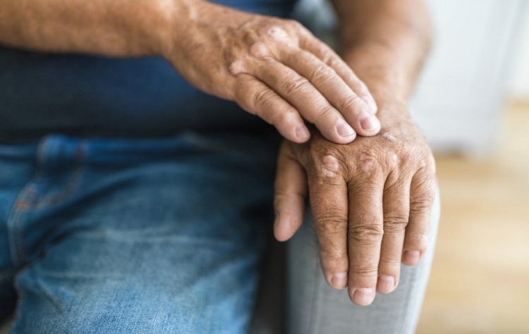 Psoriatic Arthritis Treatment Market | Trends & Growth Projections 2025