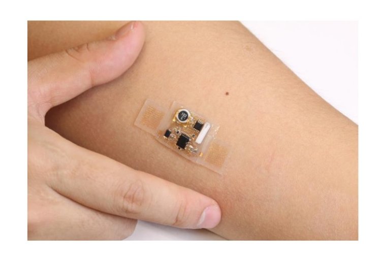 Sensor Patch Market: A Revolution in Wearable Health Technology (2025–2035)